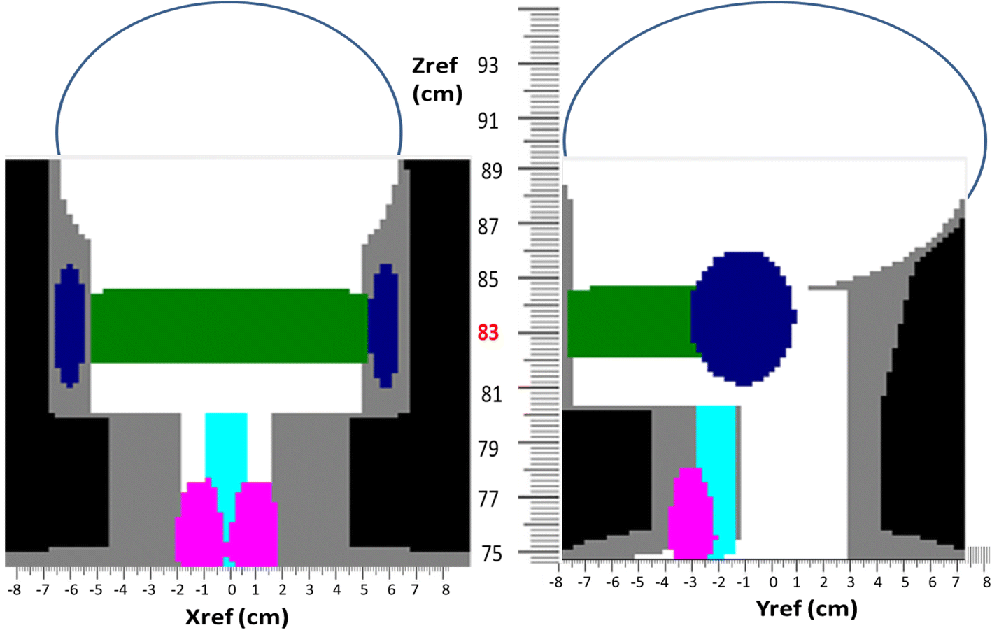 Https zref io. Cone Beam Computed tomography. CT CBCT radiation. Cone Beam Computed tomography raduiotherapy. Zref.