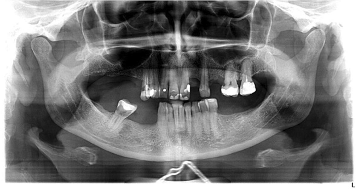 Fig. 2