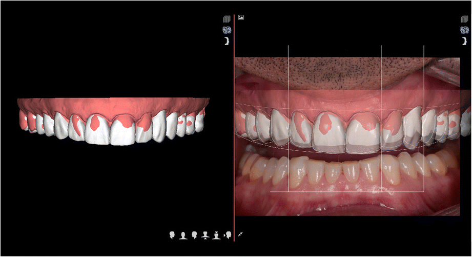 Fig. 11