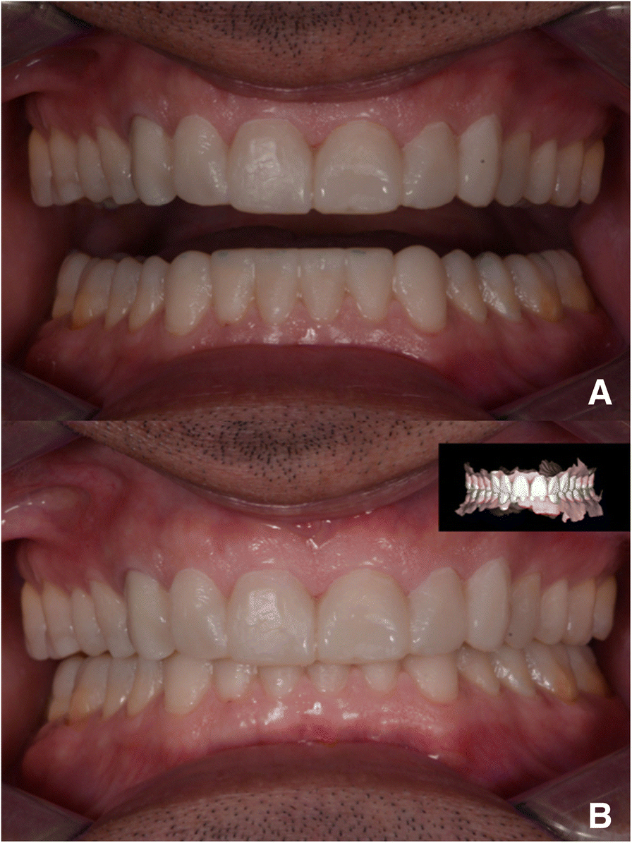 Fig. 6