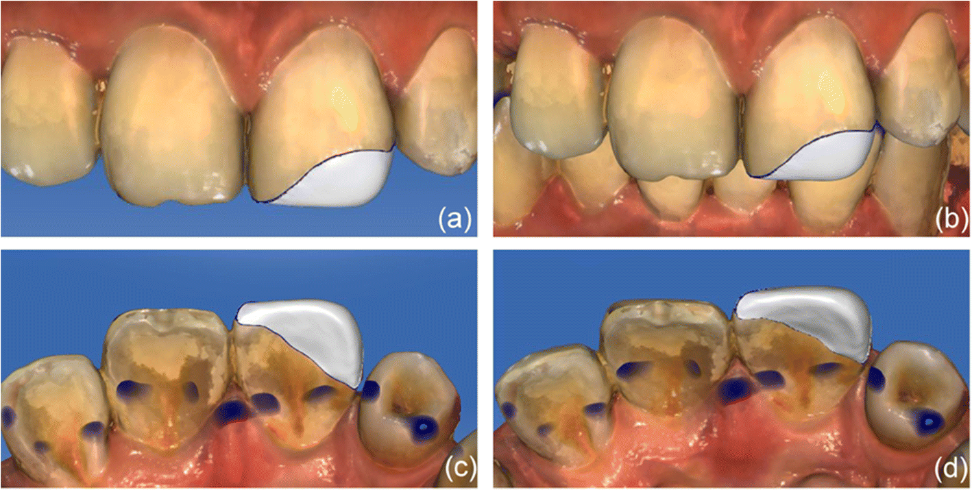 Fig. 3