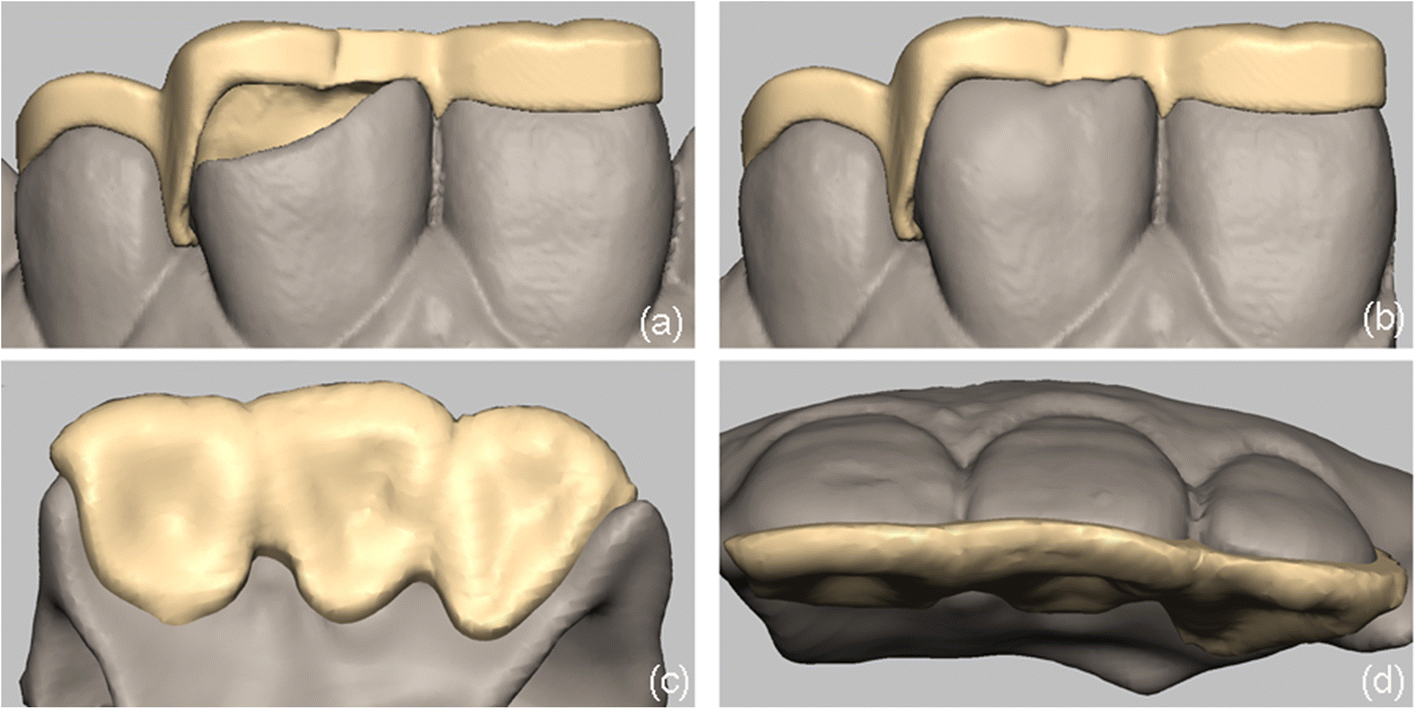 Fig. 4