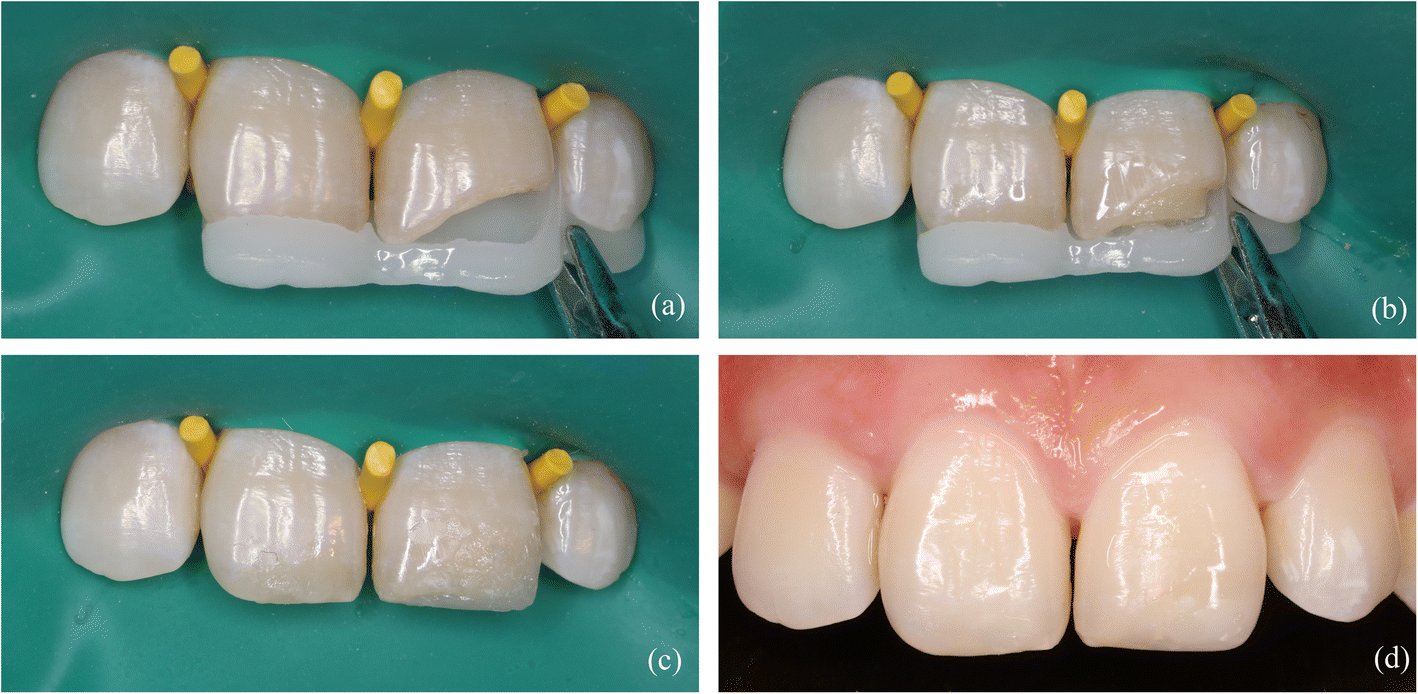 Fig. 6