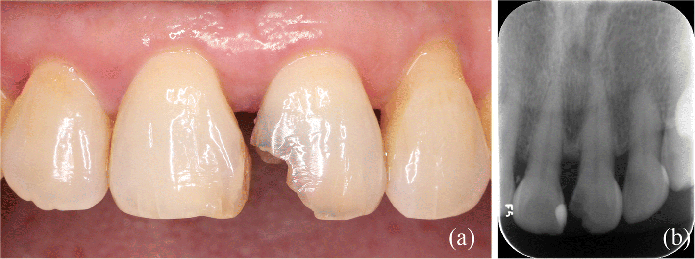 Fig. 7