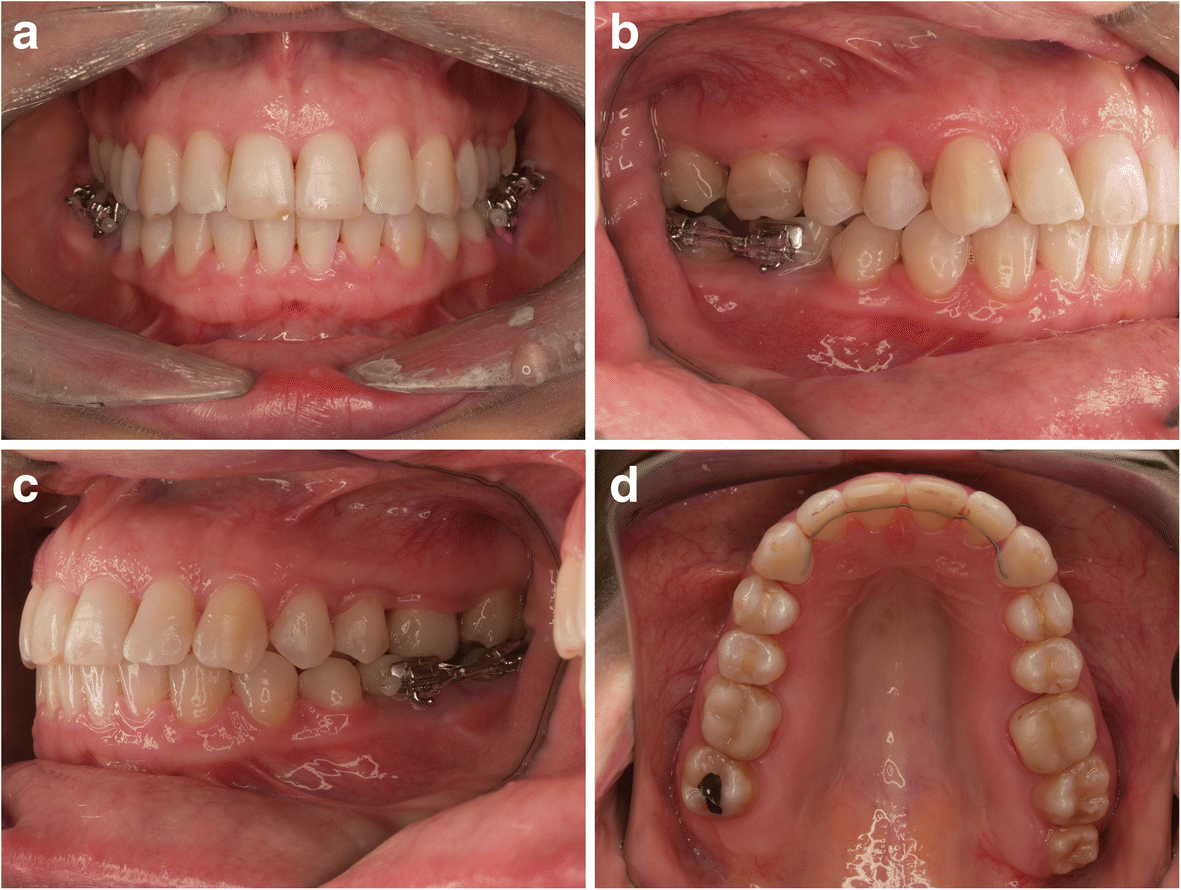 Fig. 3