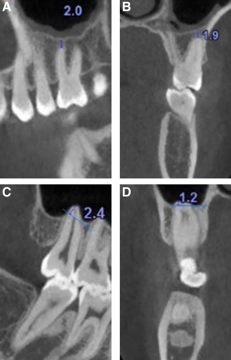 Fig. 2