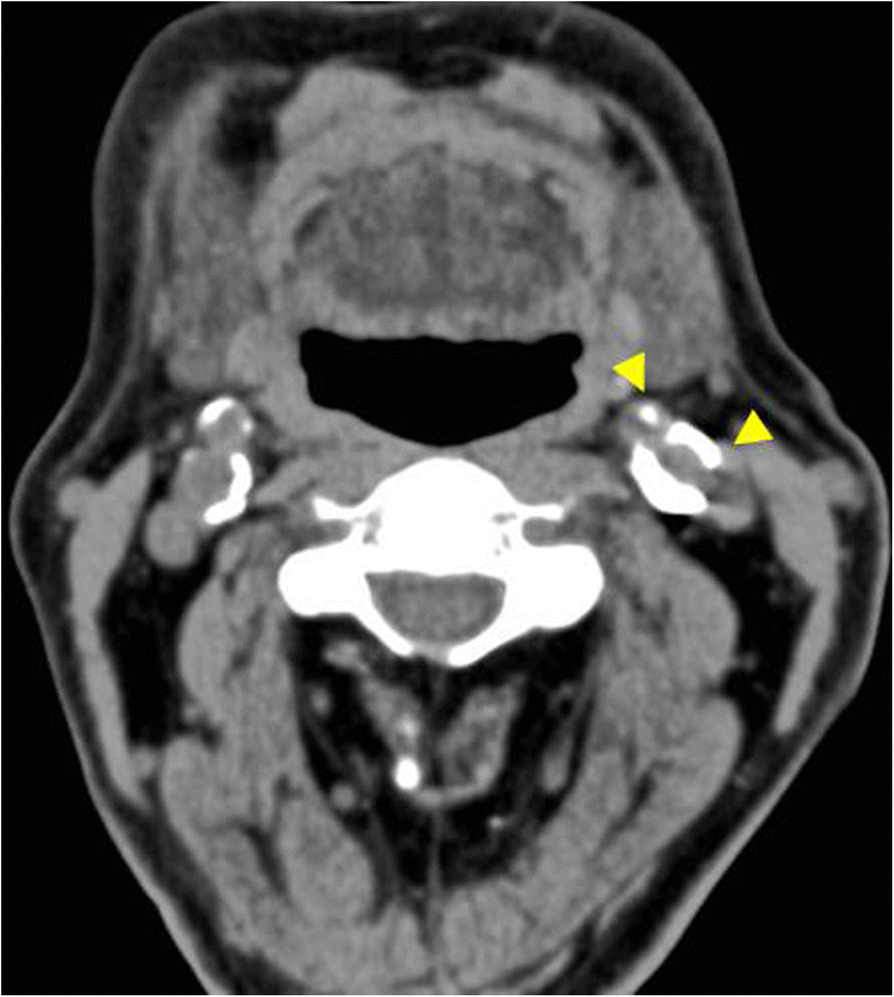 Fig. 7