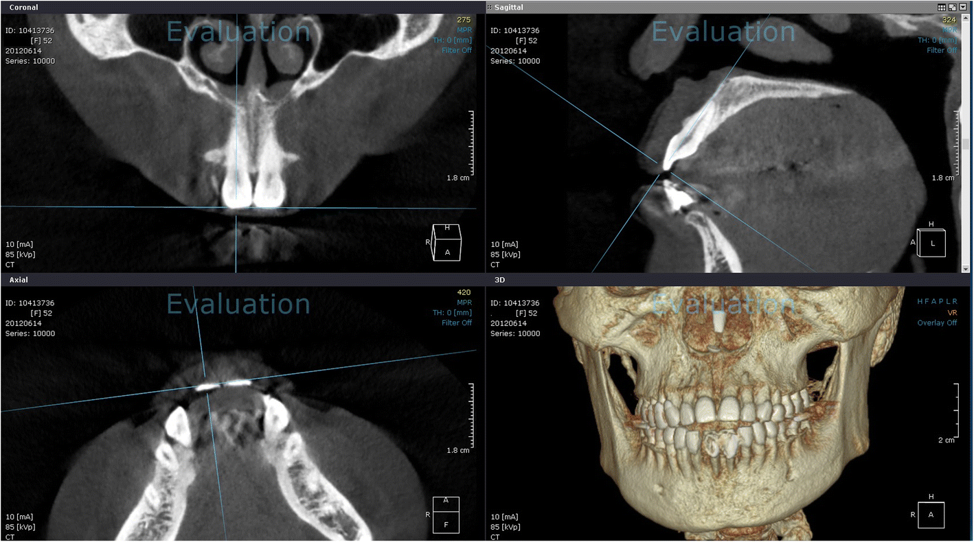 Fig. 2