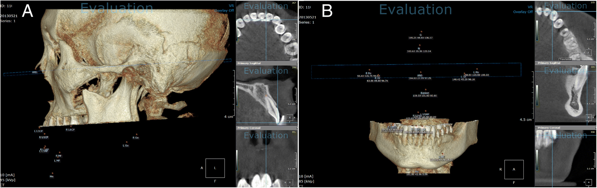 Fig. 5