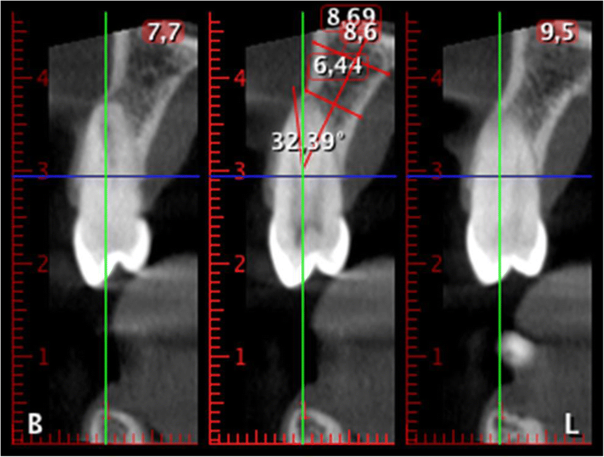 Fig. 3