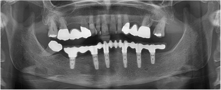 Fig. 15