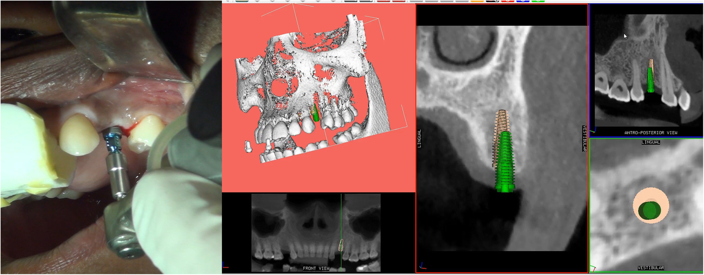 Fig. 4