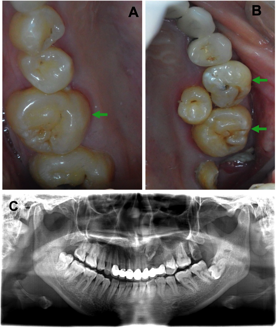 Fig. 6