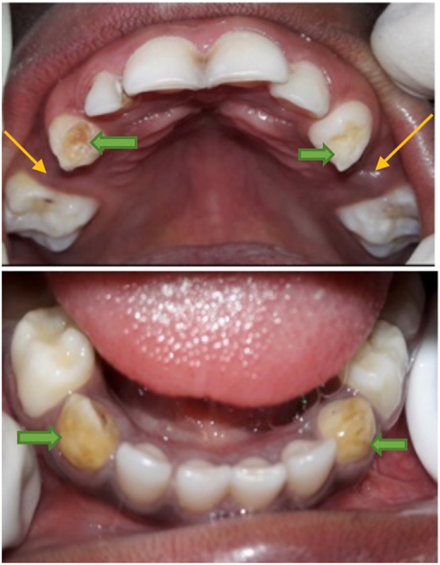 Fig. 4