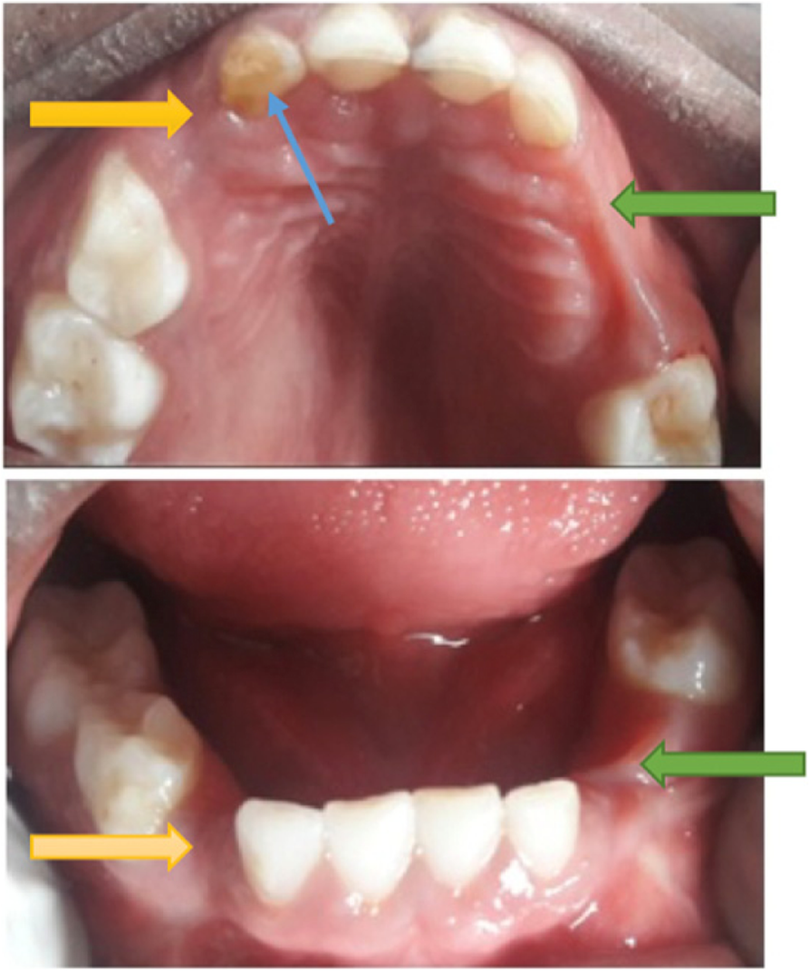 Fig. 5