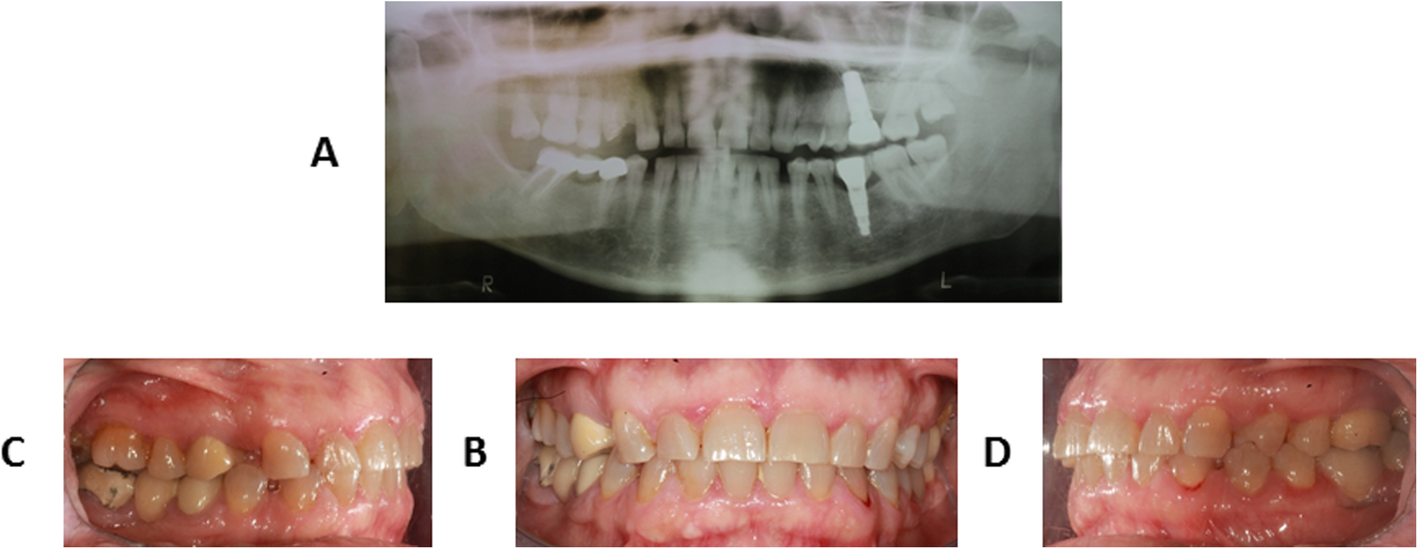 Fig. 2