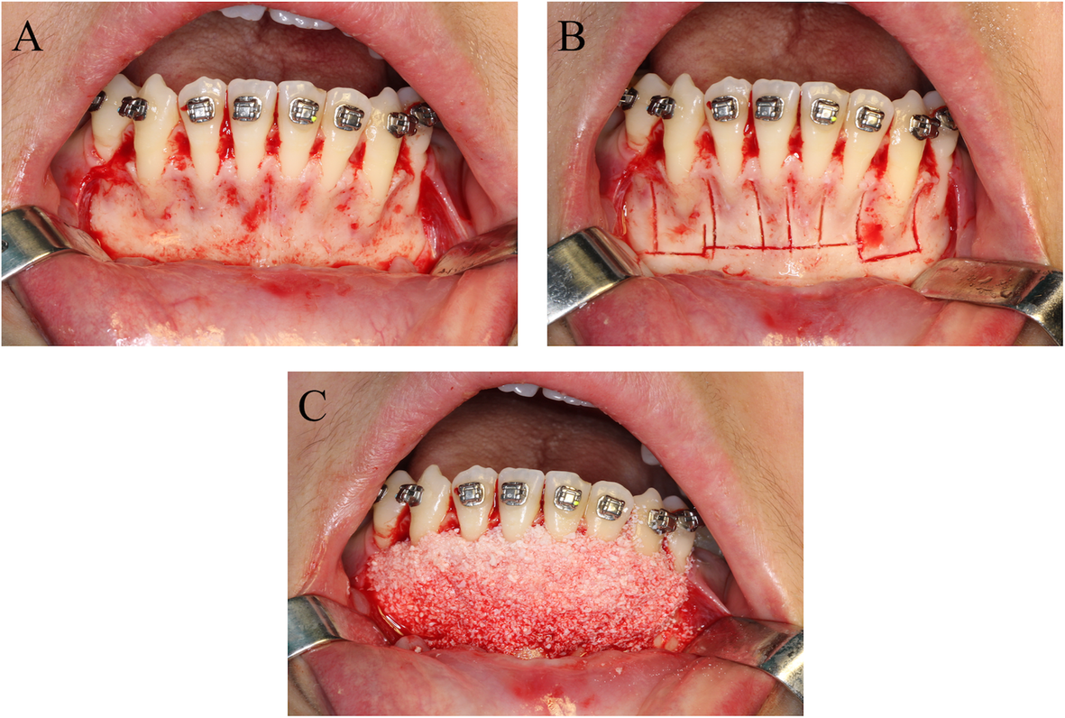 Fig. 3