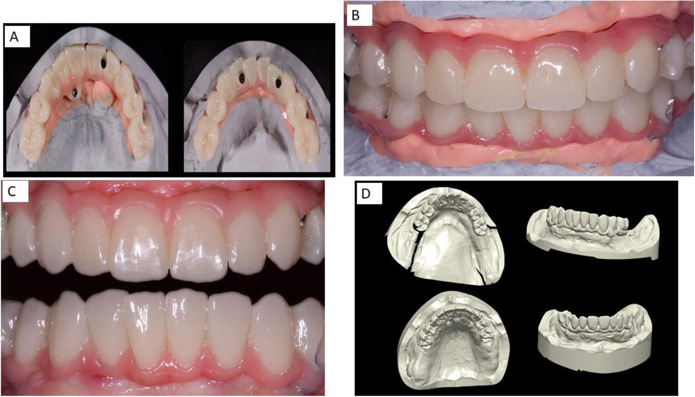 Fig. 4