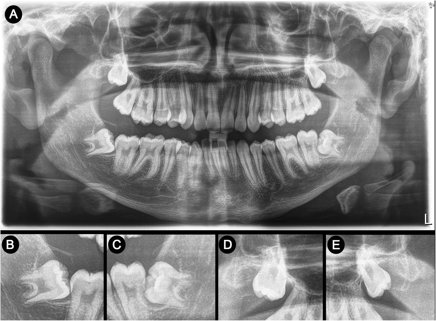 Fig. 6