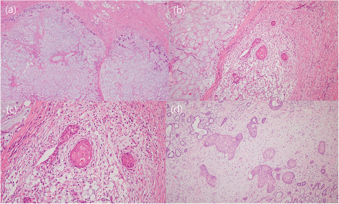 Fig. 2