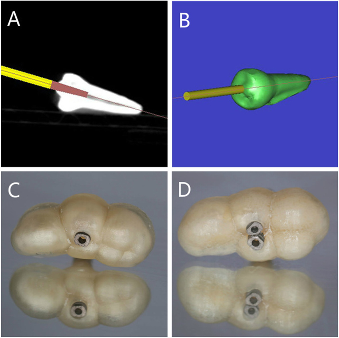 Fig. 1