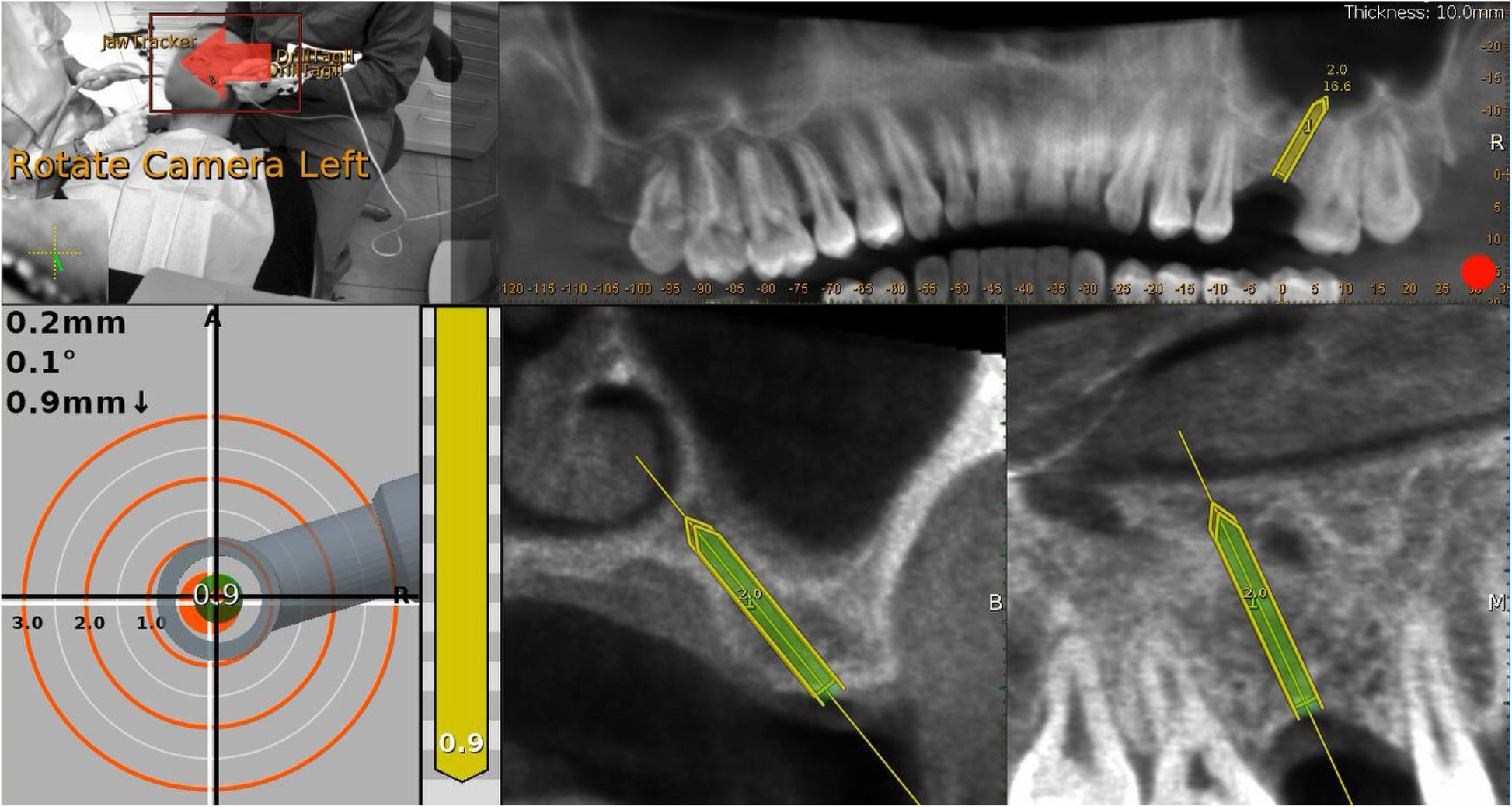 Fig. 4