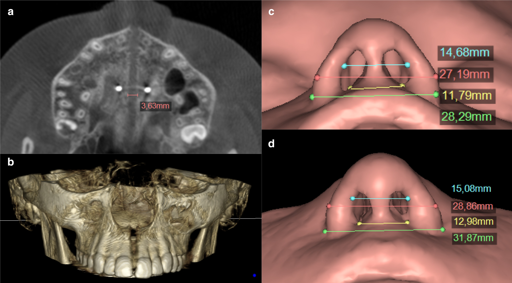 Fig. 4