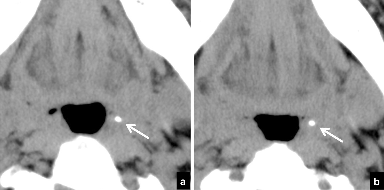 Fig. 5