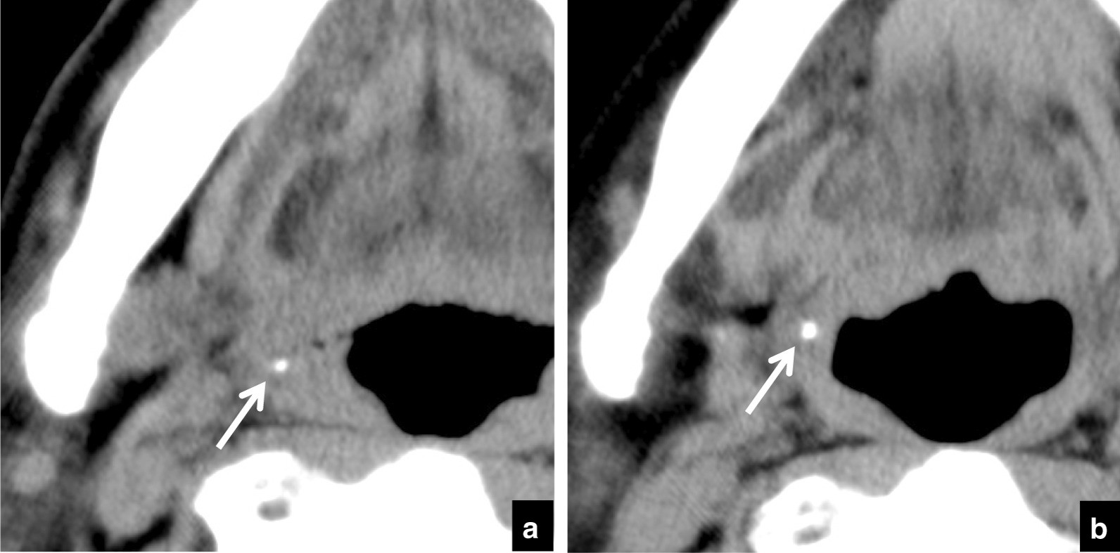 Fig. 6