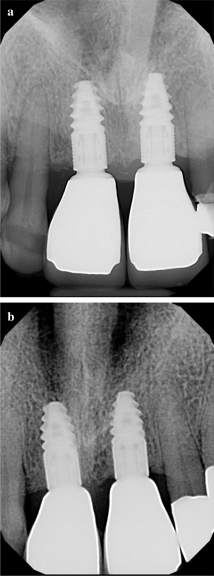 Fig. 10