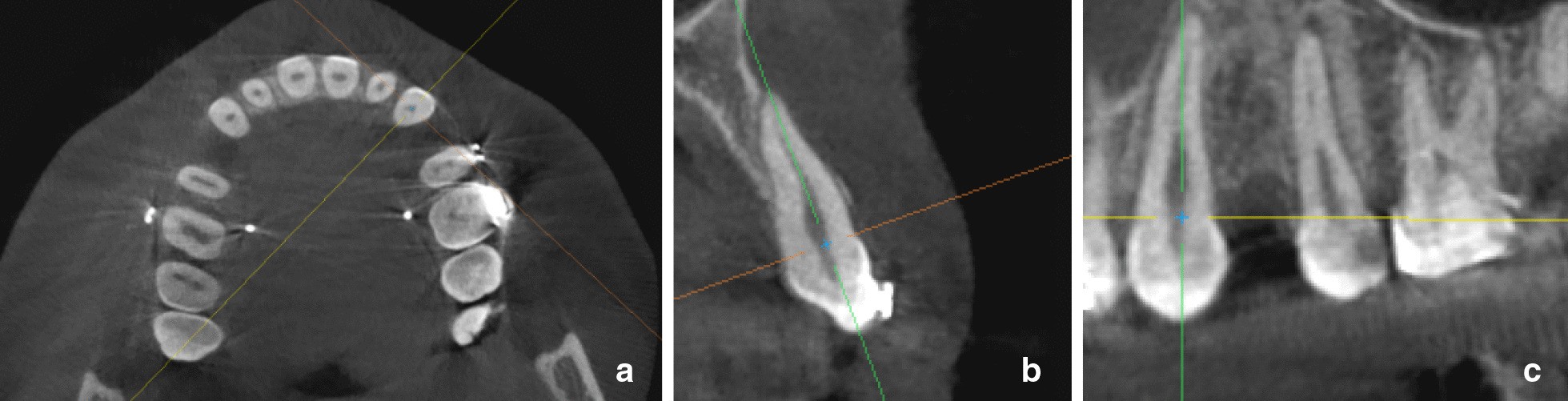 Fig. 3