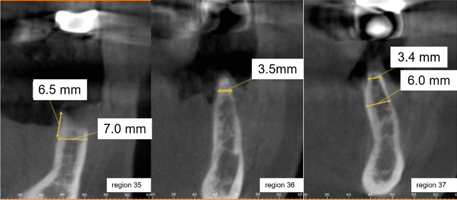 Fig. 4