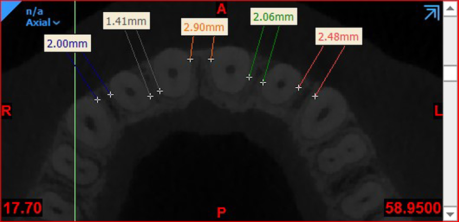 Fig. 1