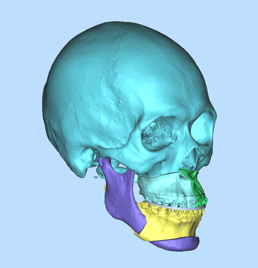 Fig. 1