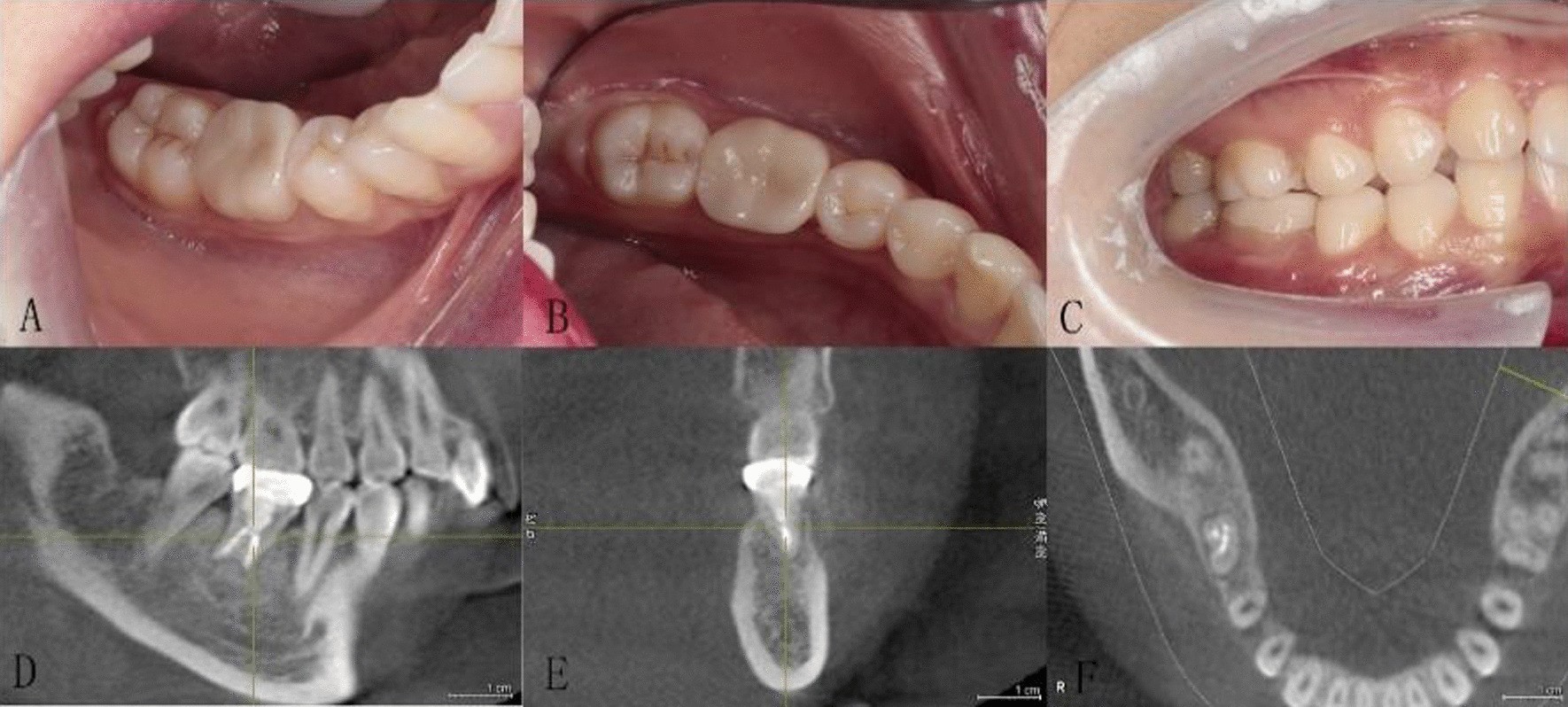 Fig. 5