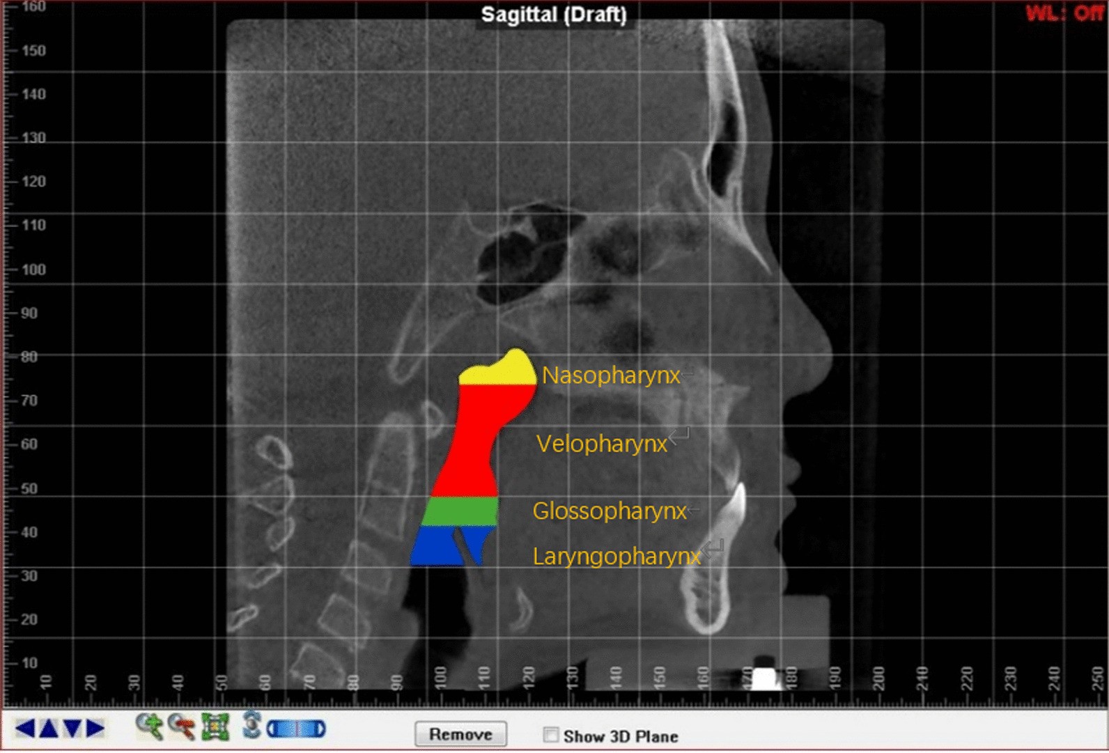 Fig. 3