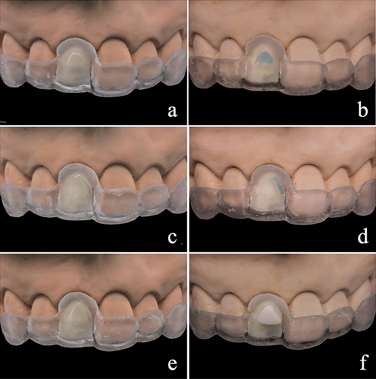 Fig. 4