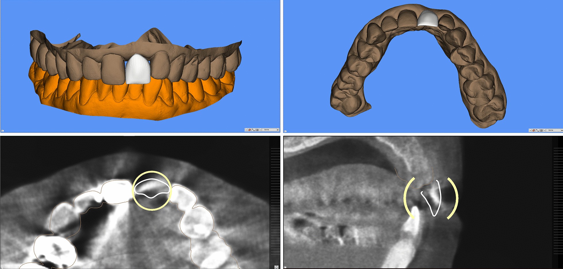 Fig. 4