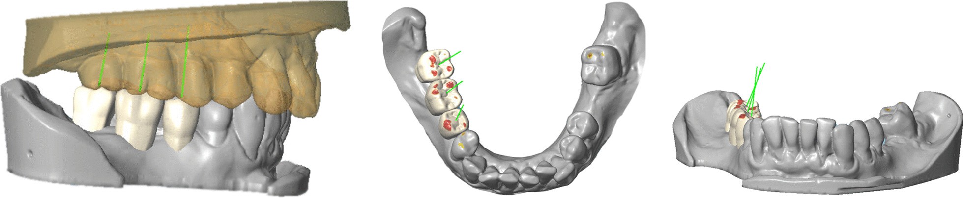 Fig. 5