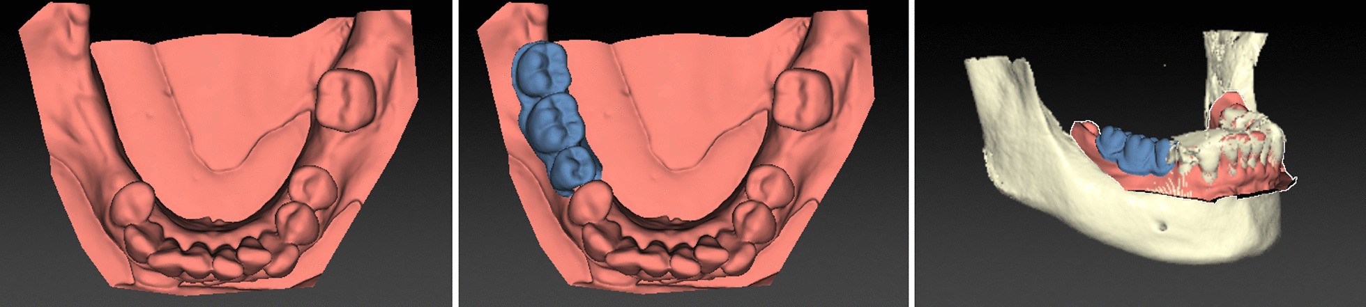 Fig. 6