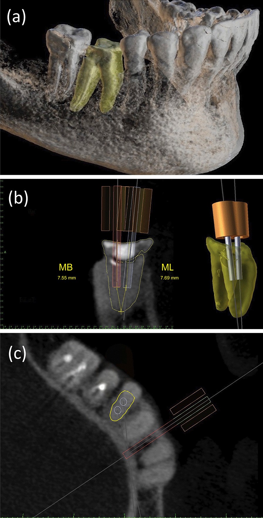 Fig. 3