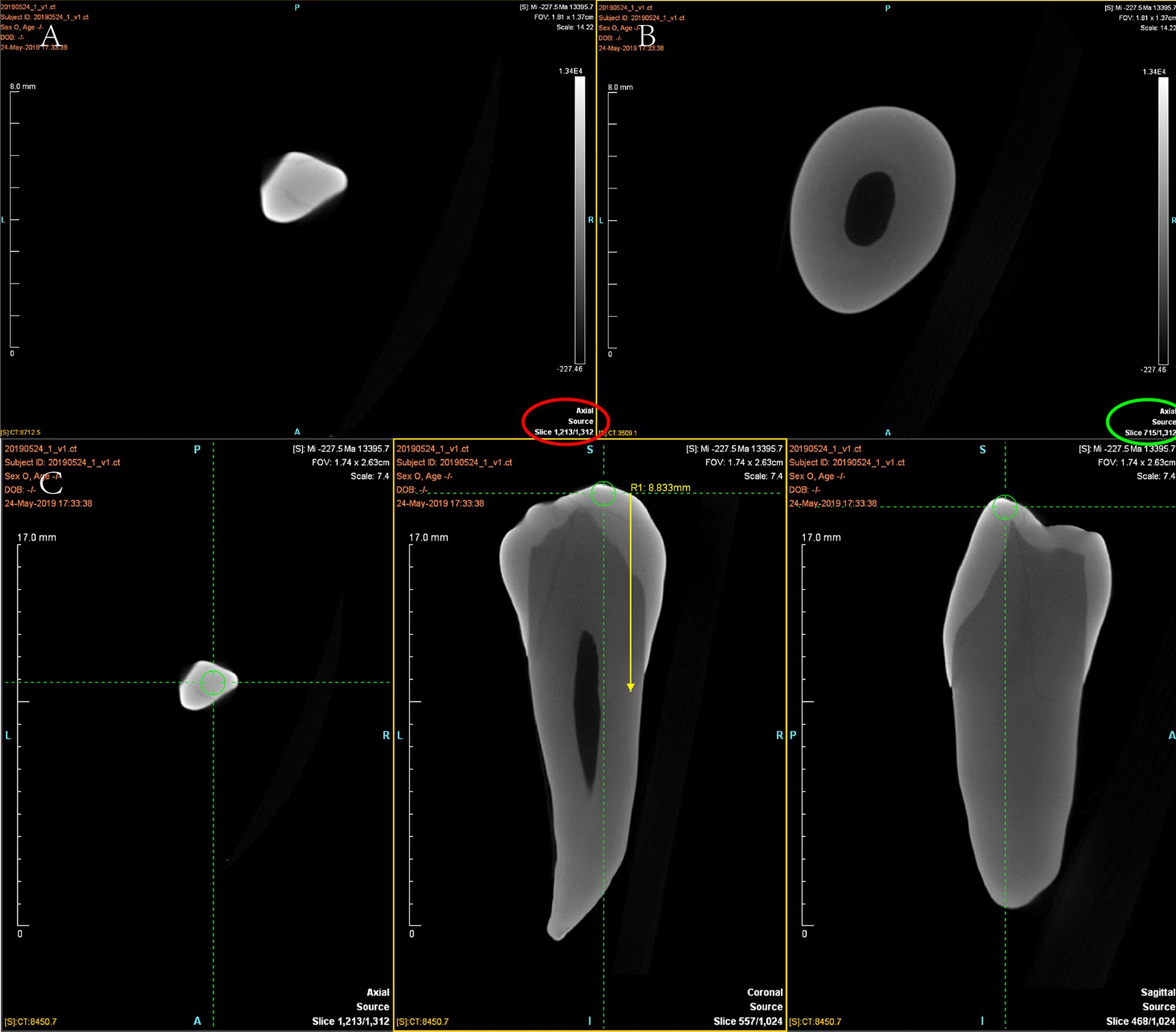 Fig. 1