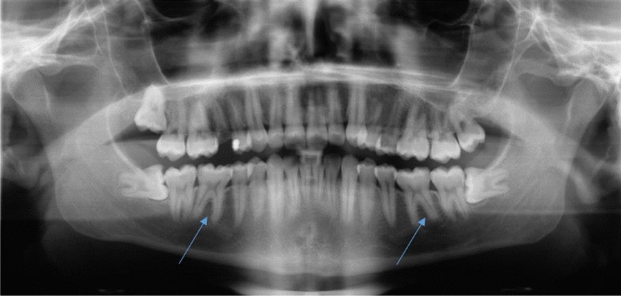 Fig. 1