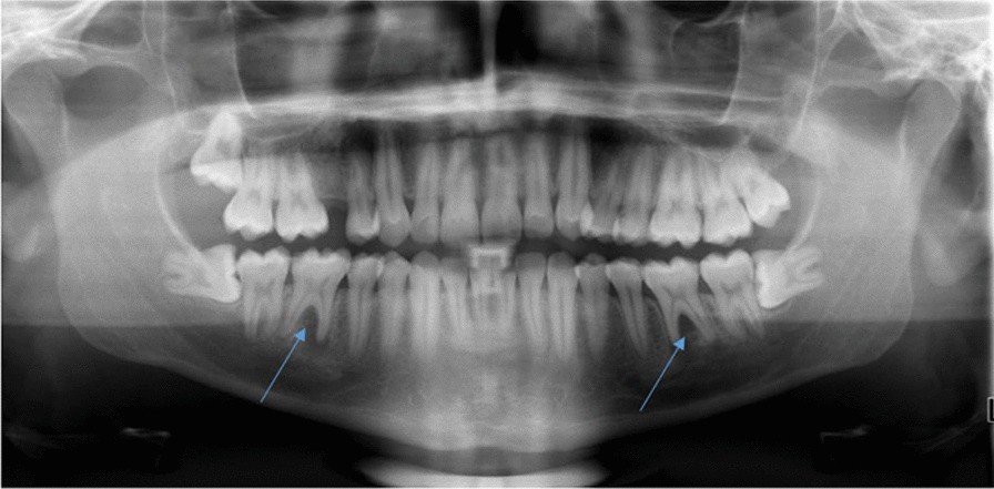 Fig. 3