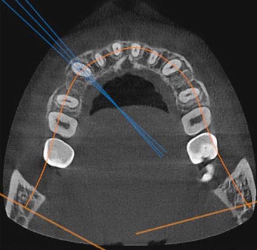 Fig. 4