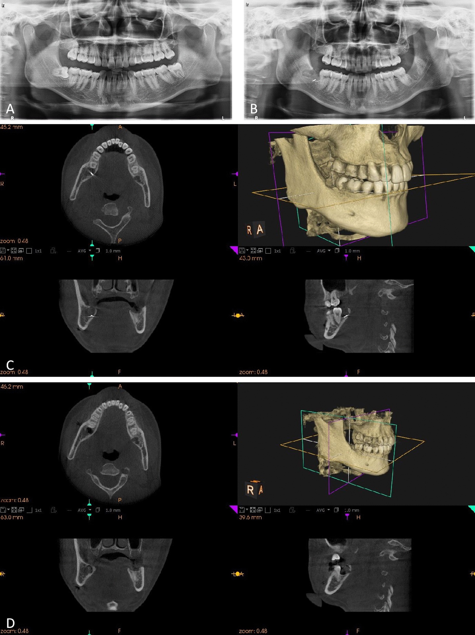 Fig. 1 