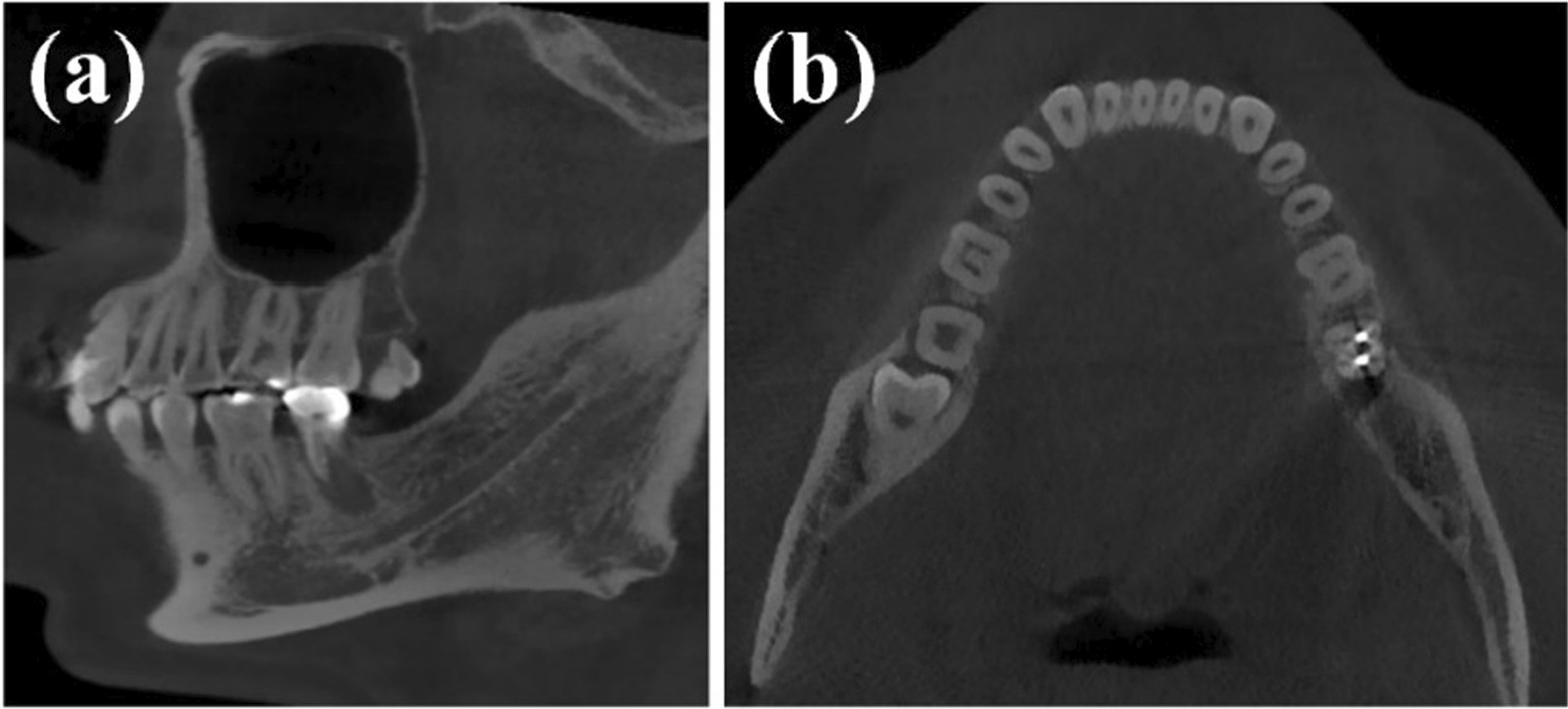 Fig. 8