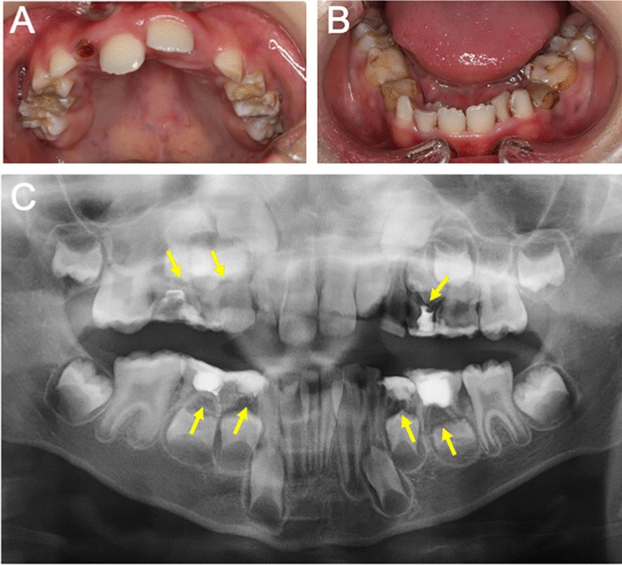 Fig. 3