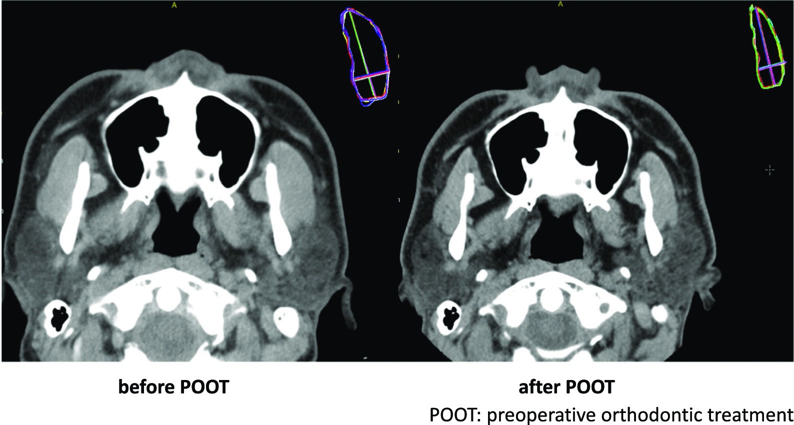 Fig.1