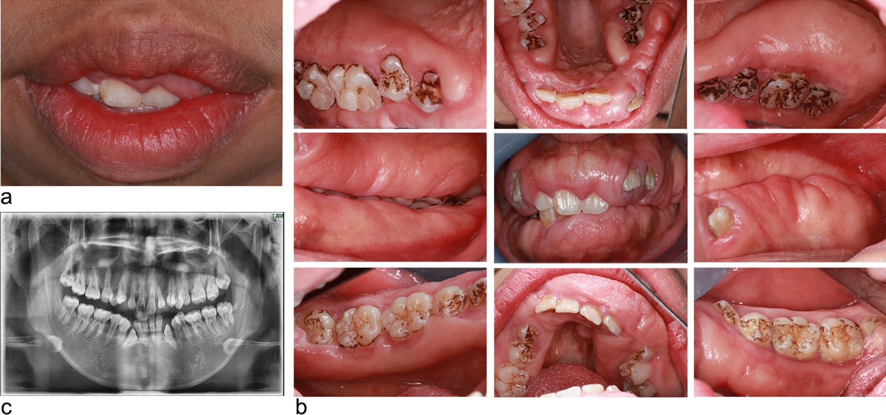 Fig. 3